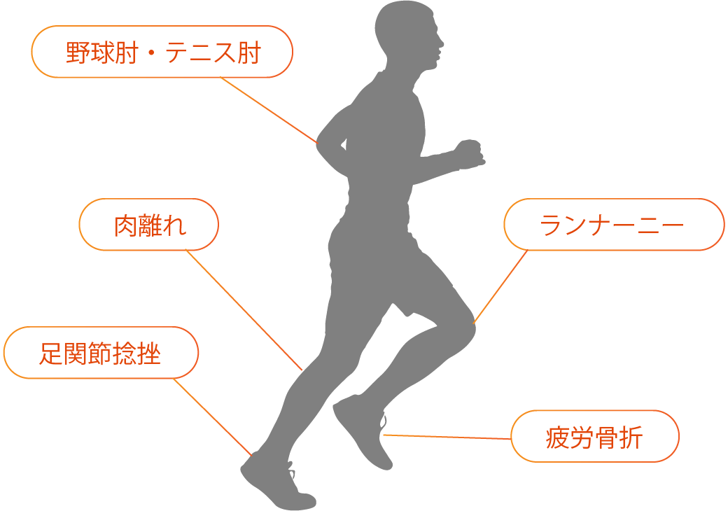 代表的な疾患
